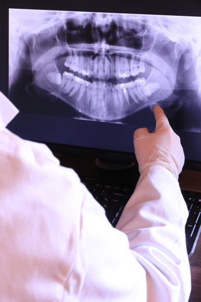Best Emergency Root Canal Treatment in Franklinville, NC