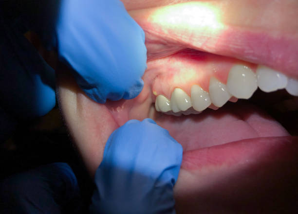 Best Emergency Dental Services for Seniors in Franklinville, NC