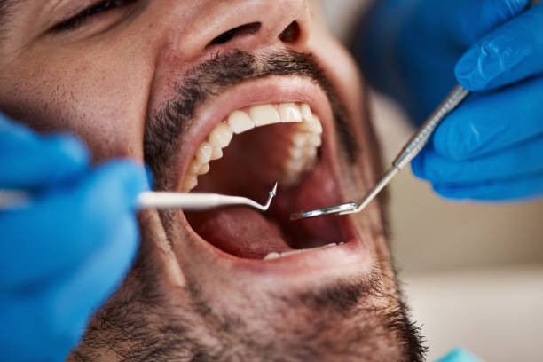 Best Weekend Emergency Dentist in Franklinville, NC